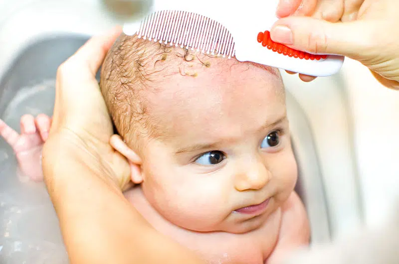 Baby hair lotion store for cradle cap