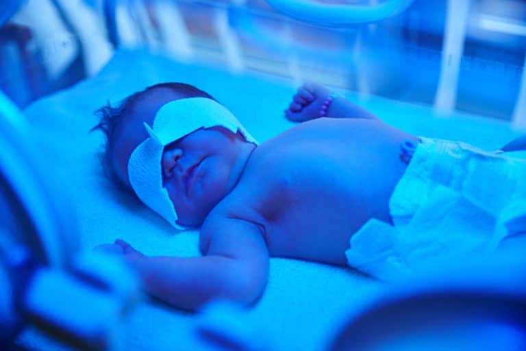Phototherapy treatment for newborn with high bilirubin level jaundice