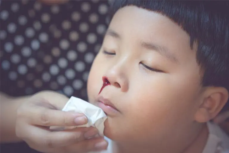 Young Boy With A Nosebleed